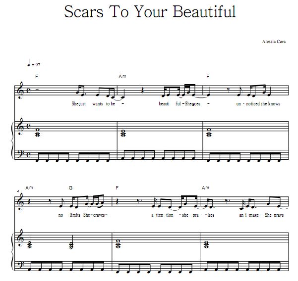 Alessia Cara - Scars To Your Beautiful ٰ